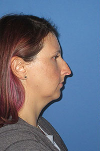 image1x1 image1x1