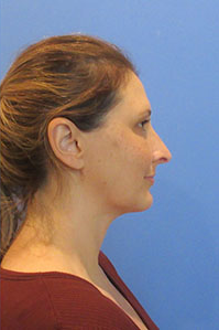 image2x1 image2x1