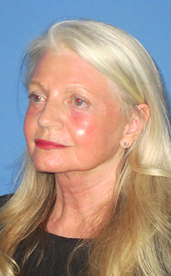 image 4 image 4